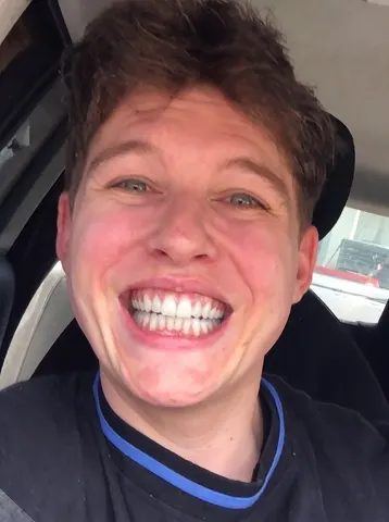 Teeth Whitener